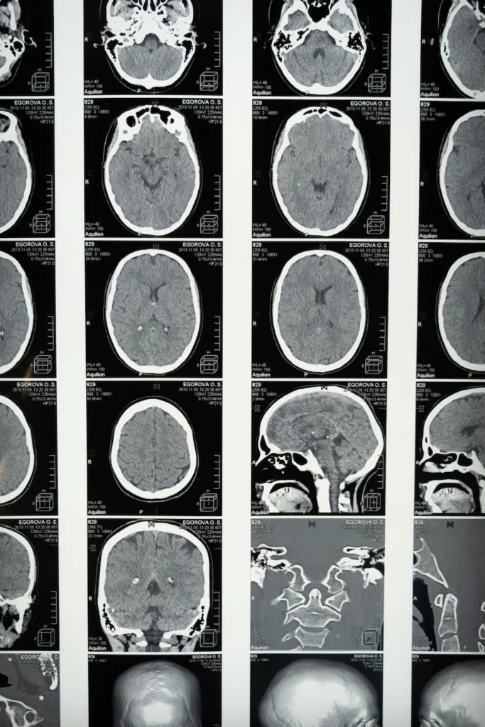 Grid showing various brain scans